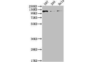 Western Blot Positive WB detected in: U87 whole cell lysate, 293 whole cell lysate, Hela whole cell lysate All lanes: FGFR3 antibody at 1:2000 Secondary Goat polyclonal to rabbit IgG at 1/50000 dilution Predicted band size: 88, 89, 76, 86 kDa Observed band size: 115 kDa (Recombinant FGFR3 anticorps)