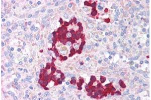 Human Spleen (formalin-fixed, paraffin-embedded) stained with AURKB antibody ABIN214031 at 5 ug/ml followed by biotinylated goat anti-rabbit IgG secondary antibody ABIN481713, alkaline phosphatase-streptavidin and chromogen. (Aurora Kinase B anticorps  (AA 227-238))