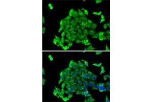 Immunofluorescence analysis of MCF7 cells using RPS14 antibody (ABIN6129109, ABIN6147198, ABIN6147199 and ABIN6222448). (RPS14 anticorps  (AA 1-151))