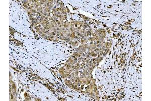 IHC analysis of HSF1 using anti-HSF1 antibody (ABIN7602894).