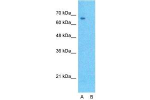 Host:  Rabbit  Target Name:  DLL1  Sample Type:  Hela  Lane A:  Primary Antibody  Lane B:  Primary Antibody + Blocking Peptide  Primary Antibody Concentration:  1ug/ml  Peptide Concentration:  5ug/ml  Lysate Quantity:  25ug/lane/lane  Gel Concentration:  0. (DLL1 anticorps  (N-Term))