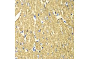 Immunohistochemistry of paraffin-embedded mouse heart using TPM3 antibody at dilution of 1:100 (400x lens). (TPM3 anticorps)