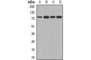 Western blot analysis of Calpain 5 expression in A431 (A), SKOV3 (B), mouse thymus (C), mouse brain (D) whole cell lysates. (Calpain 5 anticorps)