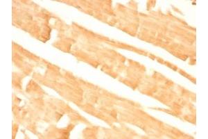 Formalin-fixed, paraffin-embedded rat heart stained with Glypican-3 antibody