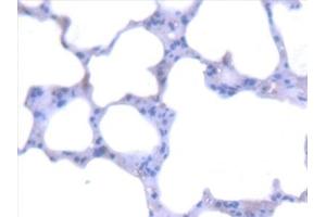 anti-Alanine Glyoxylate Aminotransferase (AGXT) (AA 120-334) antibody