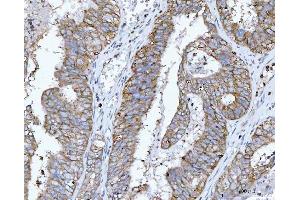 IHC analysis of RPL32 using anti-RPL32 antibody (ABIN7602916). (RPL32 anticorps  (C-Term))