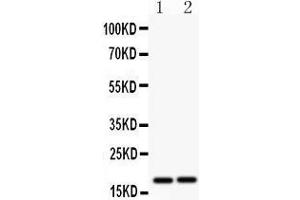 Anti- CASP8 antibody, Western blotting All lanes: Anti CASP8  at 0. (Caspase 8 anticorps  (N-Term))