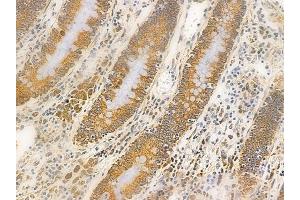 ABIN6262097 and ABIN6266556 at 1/100 staining human normal colon tissue by IHC-P. (HSPA9 anticorps  (C-Term))