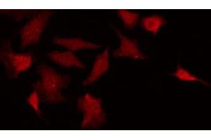 ABIN6267427 staining Hela by IF/ICC.