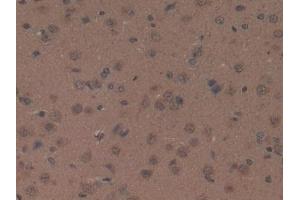 Detection of OXA in Rat Brain Tissue using Polyclonal Antibody to Orexin A (OXA) (Orexin A anticorps  (AA 32-123))