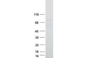 Validation with Western Blot