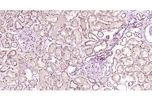 Paraformaldehyde-fixed, paraffin embedded Human kidney; Antigen retrieval by boiling in sodium citrate buffer (pH6.