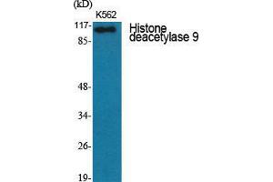 Western Blot (WB) analysis of specific cells using Histone deacetylase 9 Polyclonal Antibody. (HDAC9 anticorps  (C-Term))