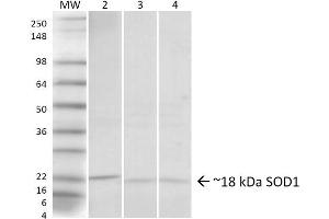 Western blot analysis of Human, Rat, Mouse Hela cells, Brain, Lung showing detection of ~18 kDa SOD1 (UBB) protein using Rabbit Anti-SOD1 (UBB) Polyclonal Antibody . (SOD1 anticorps  (N-Term) (Atto 390))