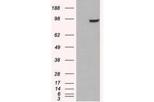 Image no. 1 for anti-phosphodiesterase 5A, cGMP-Specific (PDE5A) (C-Term) antibody (ABIN374520) (PDE5A anticorps  (C-Term))