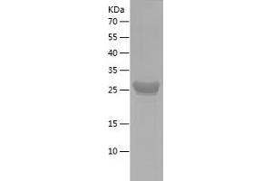 Western Blotting (WB) image for Oligodendrocyte Lineage Transcription Factor 2 (OLIG2) (AA 242-292) protein (His-IF2DI Tag) (ABIN7124256)