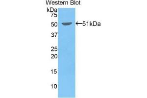 Detection of Recombinant KIF5A, Mouse using Polyclonal Antibody to Kinesin Family, Member 5A (KIF5A)