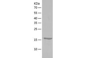 Western Blotting (WB) image for TGFB-Induced Factor Homeobox 2-Like, Y-Linked (TGIF2LY) (AA 1-185) protein (His-IF2DI Tag) (ABIN7125349)