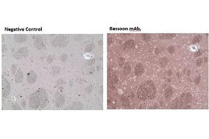 Immunohistochemistry analysis of formalin-fixed, paraffin-embedded rat brain tissue stained with Bassoon monoclonal antibody (SAP7F407),  at 10 μg/mL. (Bassoon anticorps)