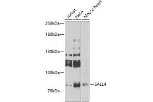 Western blot analysis of extracts of various cell lines, using SALL4 Antibody (ABIN6132627) at 1:1000 dilution. (SALL4 anticorps  (AA 1-220))