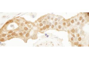 Immunohistochemistry (IHC) image for anti-Parkinson Protein 7 (PARK7) (C-Term) antibody (ABIN7448532) (PARK7/DJ1 anticorps  (C-Term))