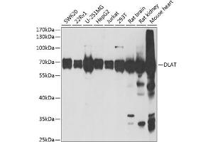 Western blot analysis of extracts of various cell lines, using DLAT antibody (ABIN6129524, ABIN6139639, ABIN6139640 and ABIN6221886) at 1:1000 dilution. (DLAT anticorps  (AA 1-290))