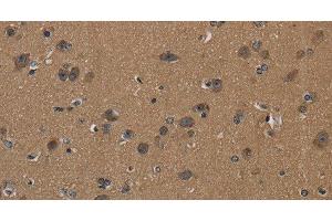 Immunohistochemistry of paraffin-embedded Human brain using CD242 Polyclonal Antibody at dilution of 1:50 (ICAM4 anticorps)