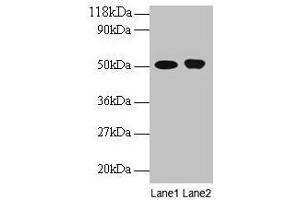 Western blot All lanes: ODC1 antibody at 2 μg/mL Lane 1: EC109 whole cell lysate Lane 2: 293T whole cell lysate Secondary Goat polyclonal to rabbit IgG at 1/15000 dilution Predicted band size: 52 kDa Observed band size: 52 kDa (ODC1 anticorps  (AA 1-461))