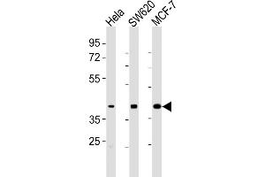 All lanes : Anti-HPN Antibody (Center) at 1:2000 dilution Lane 1: Hela whole cell lysates Lane 2: S whole cell lysates Lane 3: MCF-7 whole cell lysates Lysates/proteins at 20 μg per lane. (Hepsin anticorps  (AA 153-188))