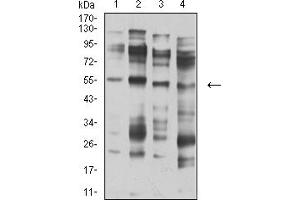 Western blot analysis using CHRNA5 mouse mAb against membrane protein lysate of C6 (1), membrane protein lysate of SK-N-SH (2), membrane protein lysate of C6 (3), and C6 (4) cell lysate.