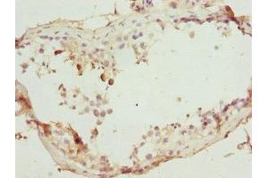Immunohistochemistry of paraffin-embedded human testis tissue using ABIN7172439 at dilution of 1:100