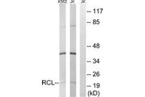 Western Blotting (WB) image for anti-Chromosome 6 Open Reading Frame 108 (C6orf108) (AA 1-50) antibody (ABIN2890227) (RCL anticorps  (AA 1-50))