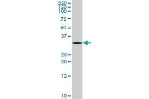 SNRPA MaxPab rabbit polyclonal antibody. (SNRPA1 anticorps  (AA 1-282))