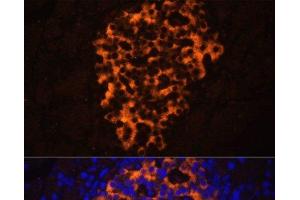 Immunofluorescence analysis of Rat pancreas using PNLIPRP2 Polyclonal Antibody at dilution of 1:100. (PNLIPRP2 anticorps)