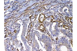 IHC analysis of VEGF Receptor 3 using anti-VEGF Receptor 3 antibody .