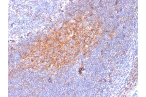 Formalin-fixed, paraffin-embedded human Lymph Node stained with CD81 Mouse Monoclonal Antibody (1. (CD81 anticorps)