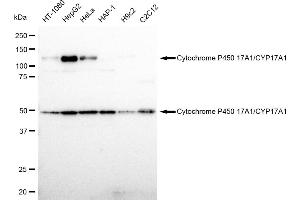 Western blotting analysis using Cytochrome P450 17A1/CYP17A1 antibody (ABIN7798251).