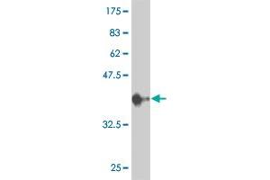 Western Blot detection against Immunogen (36. (ERK1 anticorps  (AA 279-379))