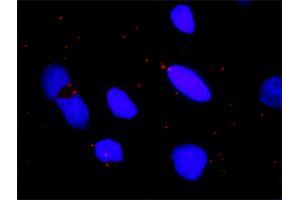 Proximity Ligation Analysis of protein-protein interactions between IKBKB and CHUK.