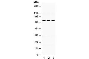 Western blot testing of human 1) HeLa, 2) MCF7 and 3) SW620 lysate wtih KEAP1 antibody. (KEAP1 anticorps  (AA 25-205))