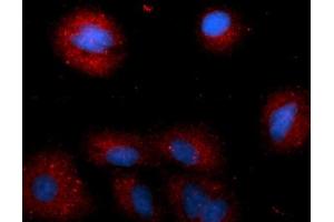 Immunofluorescence (IF) image for anti-Cathepsin E (CTSE) (AA 57-363) antibody (PE) (ABIN5565234) (Cathepsin E anticorps  (AA 57-363) (PE))
