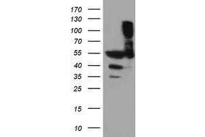 Western Blotting (WB) image for anti-Tubulin, alpha-Like 3 (TUBAL3) (AA 150-446) antibody (ABIN1490951) (TUBAL3 anticorps  (AA 150-446))