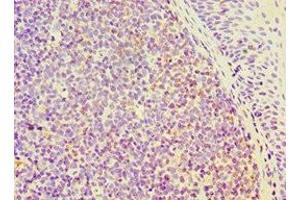 Immunohistochemistry of paraffin-embedded human tonsil tissue using ABIN7168802 at dilution of 1:100 (SEMA4C anticorps  (AA 749-833))