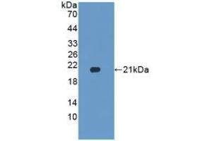 Detection of Recombinant HPA, Rat using Polyclonal Antibody to Heparanase (HPSE)