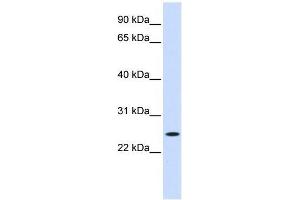 Western Blot showing NOL3 antibody used at a concentration of 1-2 ug/ml to detect its target protein. (NOL3 anticorps  (Middle Region))