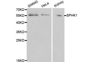 Western blot analysis of extracts of various cell lines, using SPHK1 antibody. (SPHK1 anticorps  (AA 50-384))