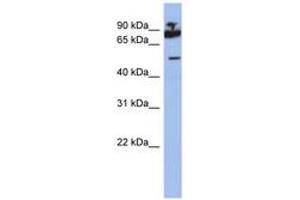 Image no. 1 for anti-IKAROS Family Zinc Finger 1 (Ikaros) (IKZF1) (AA 395-444) antibody (ABIN6742315) (IKZF1 anticorps  (AA 395-444))