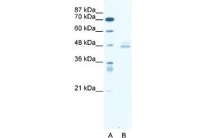 WB Suggested Anti-LDB1 Antibody Titration:  0. (LIM Domain Binding 1 Protein anticorps  (Middle Region))