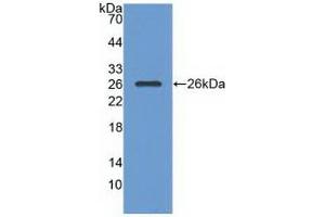 Detection of Recombinant RASA1, Human using Polyclonal Antibody to Ras GTPase Activating Protein 1 (RASA1) (RASA1 anticorps  (AA 403-596))