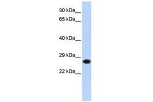 Image no. 1 for anti-Proteasome Subunit alpha 2 (PSMA2) (AA 36-85) antibody (ABIN6741386) (PSMA2 anticorps  (AA 36-85))